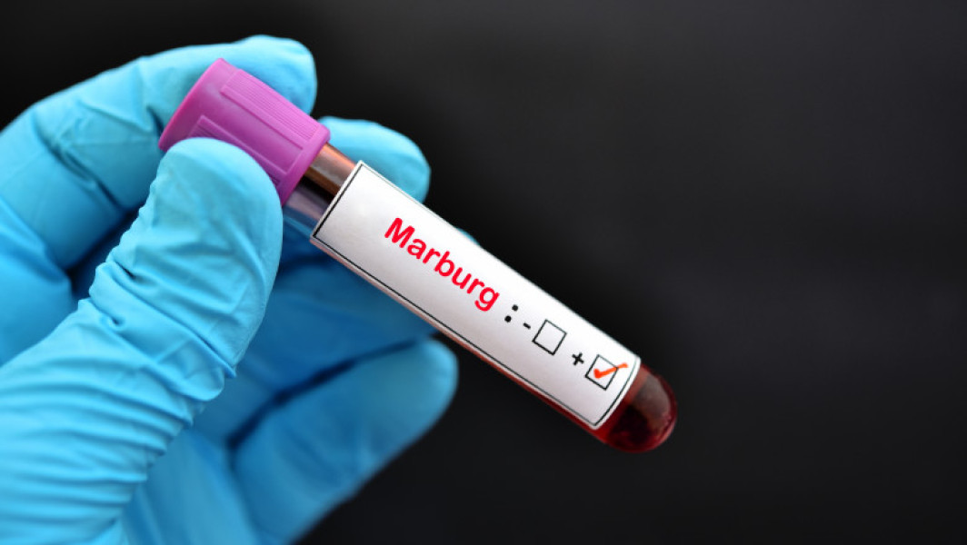 Virusul Marburg: Un risc de sănătate, dar nu o epidemie în România