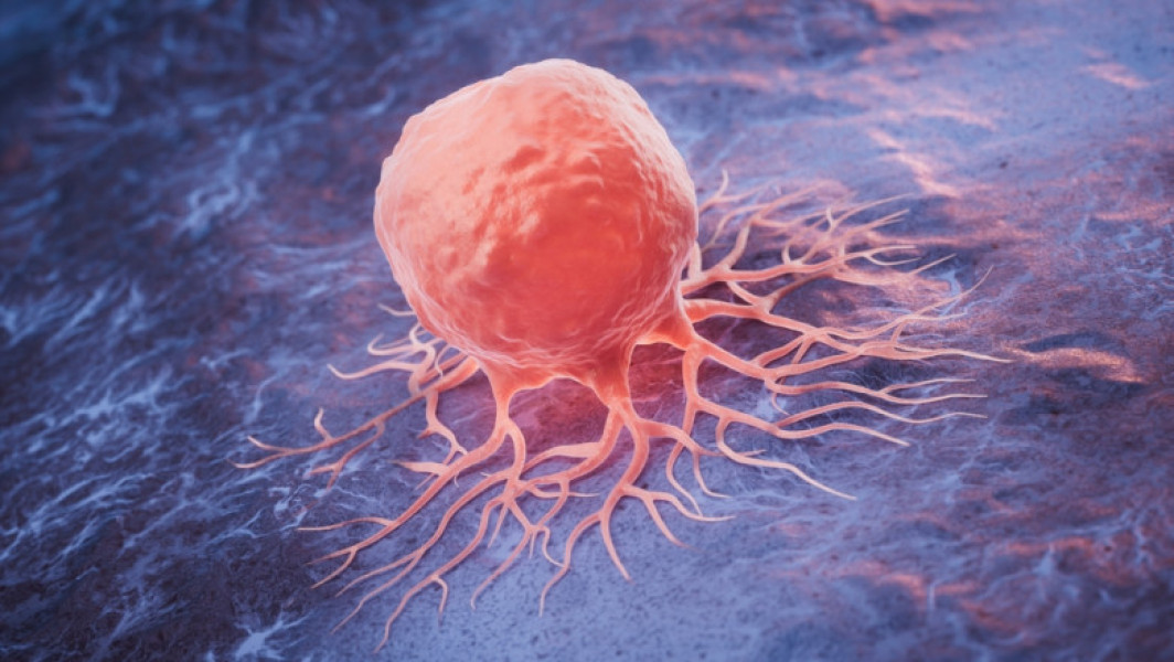 Numărul deceselor cauzate de cancer va crește semnificativ până în 2050