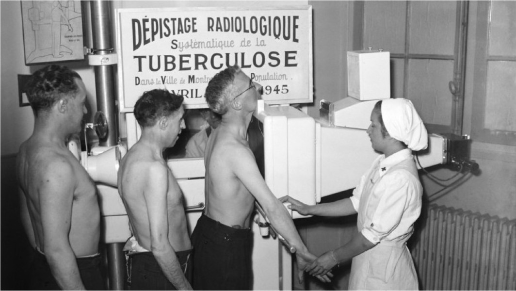 Campania din 1957 din Glasgow a salvat mii de vieți prin testare în masă a tuberculozei