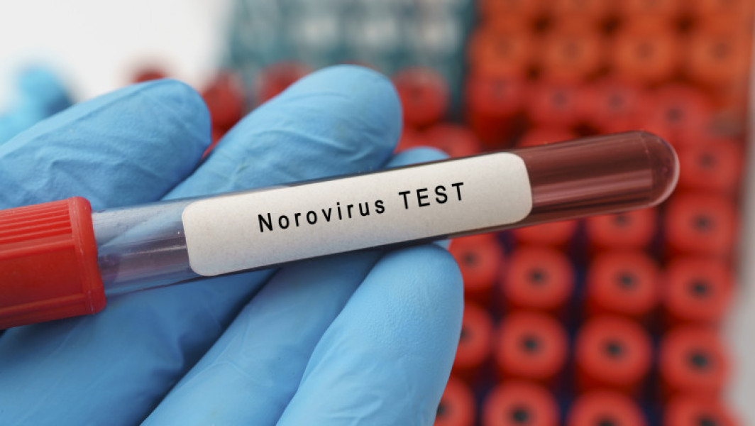 Norovirusul afectează liceul din Timișoara prin dureri și simptome digestive. Infecția se răspândește rapid și persistă câteva zile, iar igienizarea suprafețelor este esențială